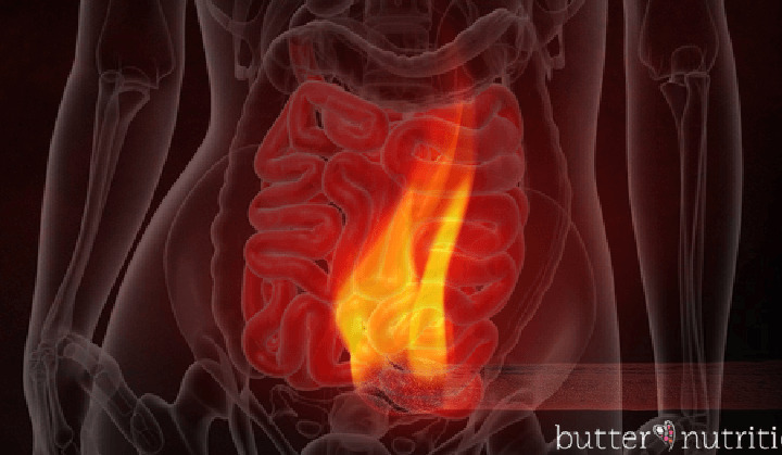 How to Flip the Switch on Inflammation | Butter Nutrition